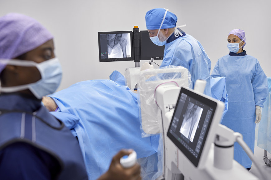 PHILIPS EXTENDS ITS MOBILE C-ARM RANGE WITH ZENITION 30
